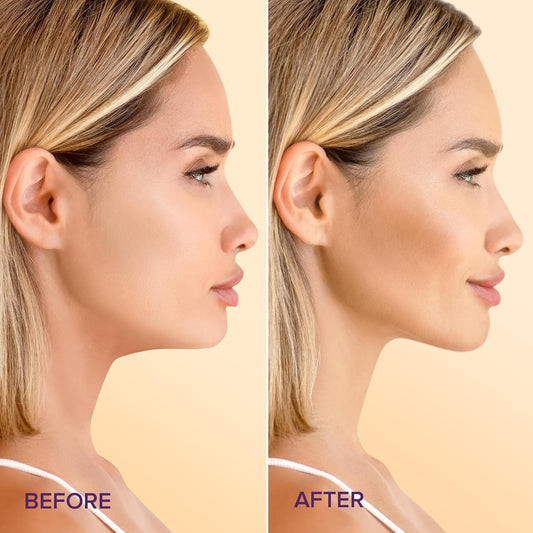 24K Gold & Collagen Chin Lift Mask